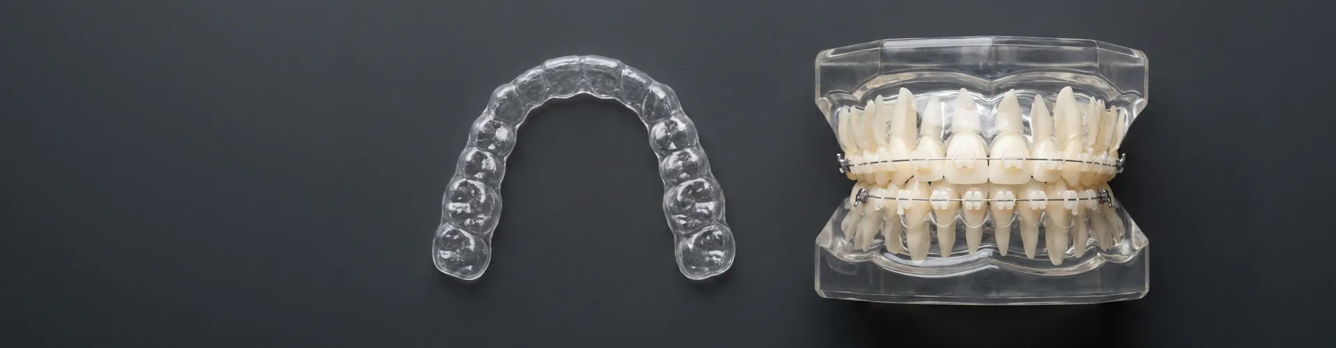 Clear aligner beside clear mouth model with ceramic braces.