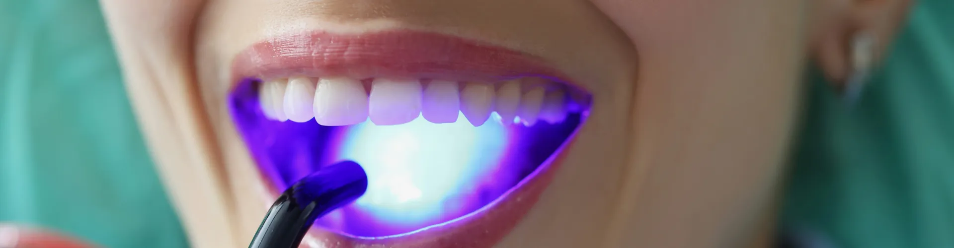 Blue light shining on woman's smile.