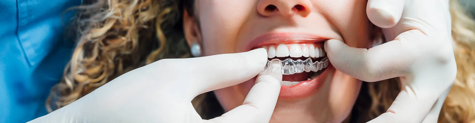 Gloved hands placing clear aligner in woman's mouth.