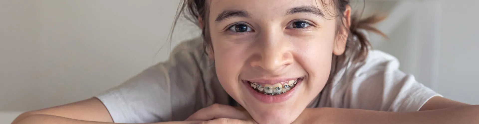 Smiling child wearing traditional metal braces, showing healthy teeth during orthodontic treatment.