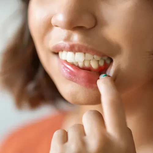 Woman pulling down lower lip to show gums.