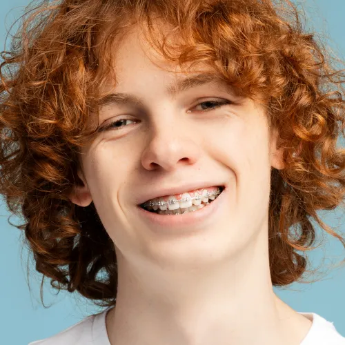 Smiling young patient wearing traditional metal braces against a light blue background.