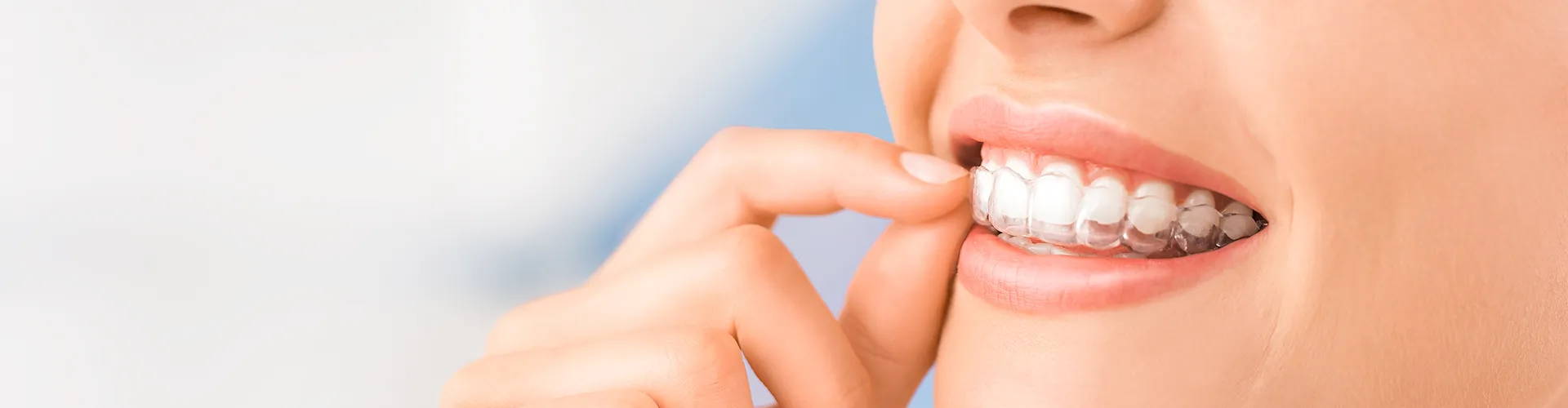 Woman placing clear retainer in her mouth.