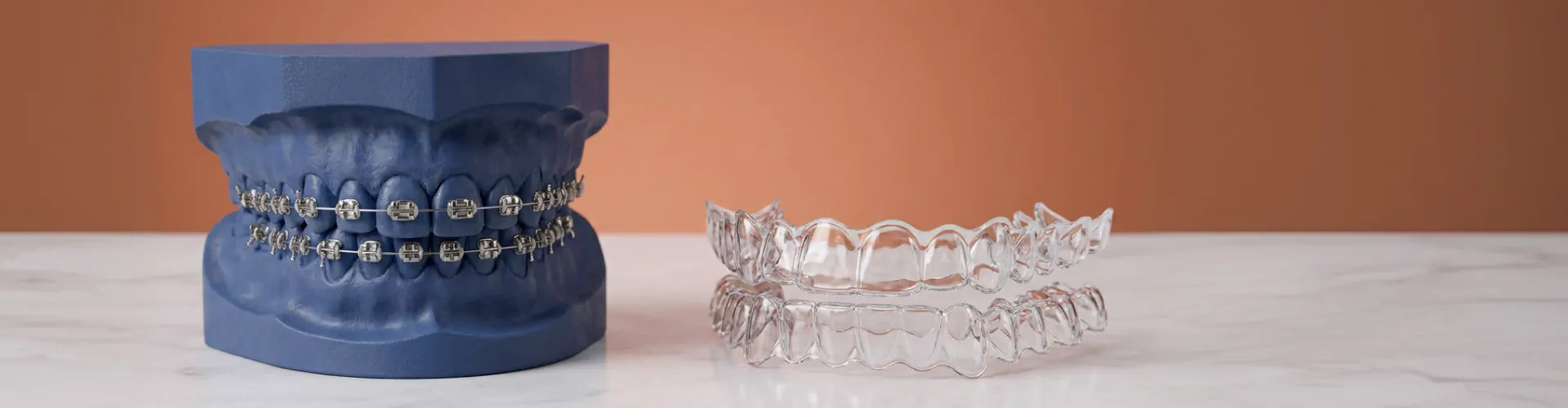 Dental model showing metal braces compared to clear plastic Invisalign aligners for teeth straightening.