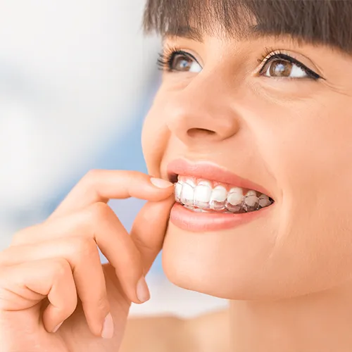 woman placing clear retainer in her mouth